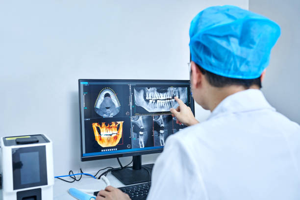Best Knocked-Out Tooth (Avulsed Tooth) Treatment in Ontario, CA